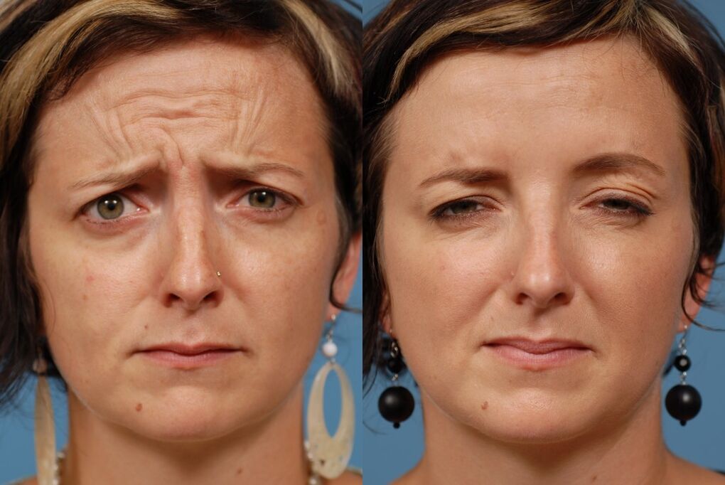 vor und nach der verwendung des ltza rejuvenation massager photo 2